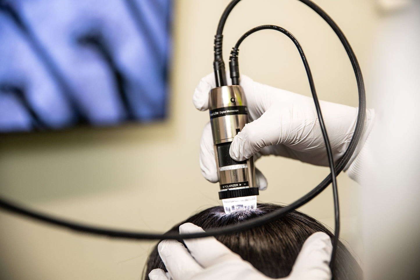 La caída de cabello no es normal: es una alerta.