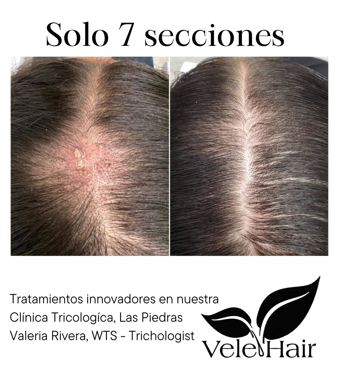 Servicio | Evaluación Tricologíca