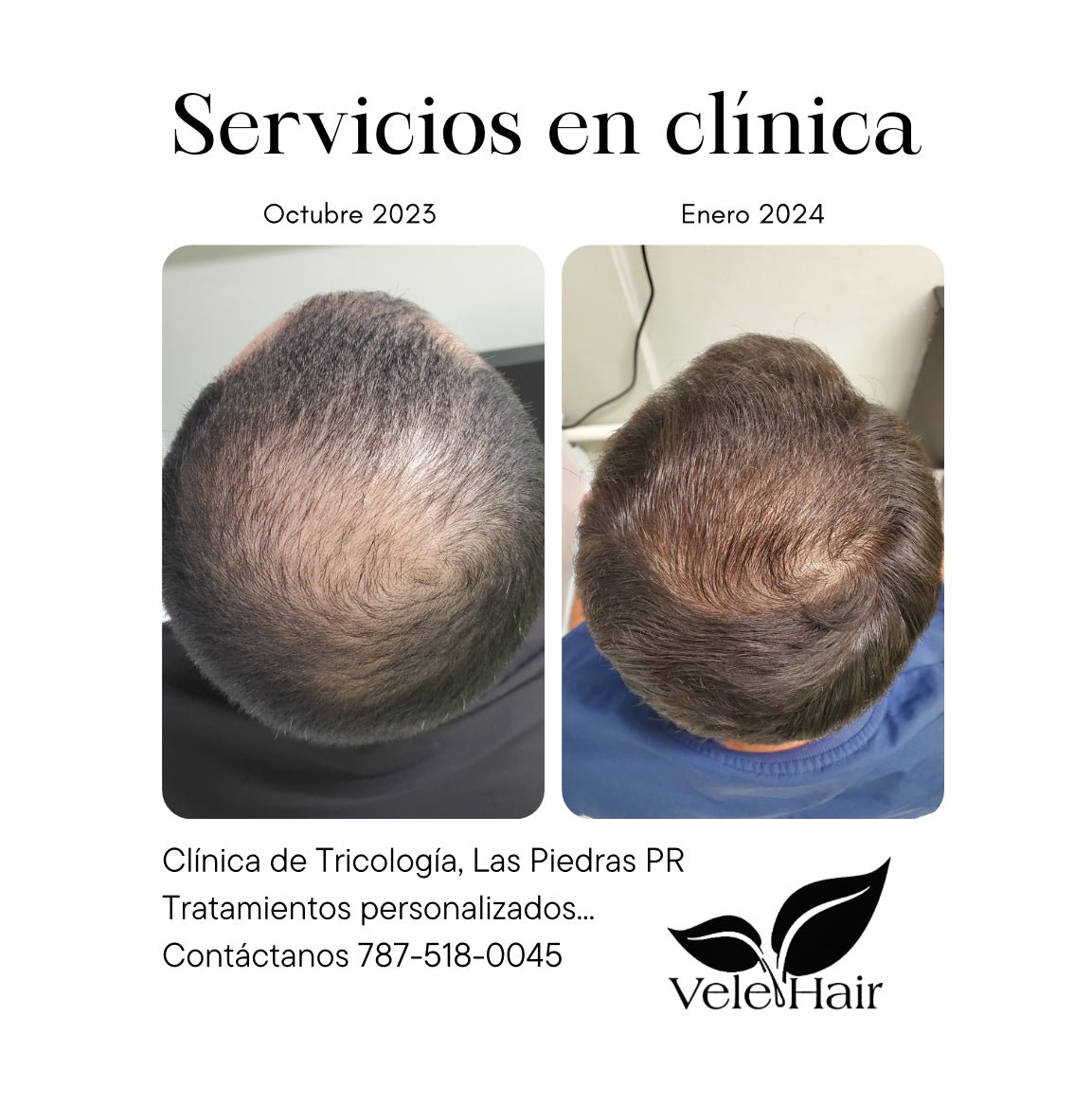 Servicio | Evaluación Tricologíca