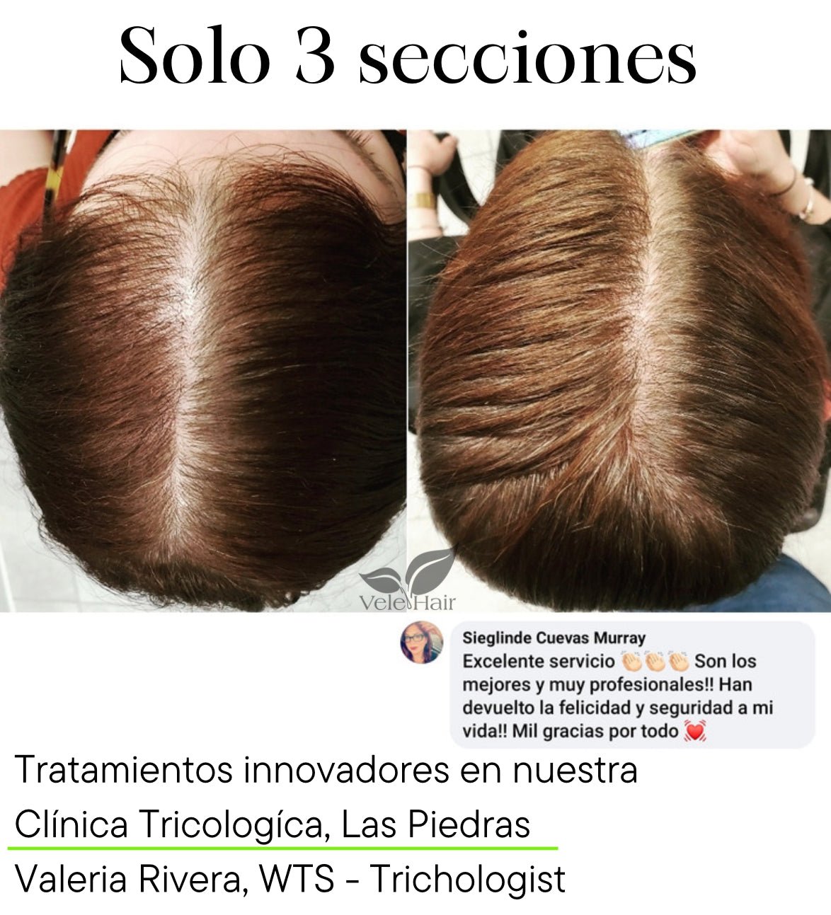 Servicio | Evaluación Tricologíca